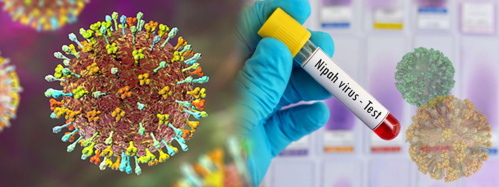 நிபா வைரஸ் குறித்து அச்சமடைய வேண்டாம்